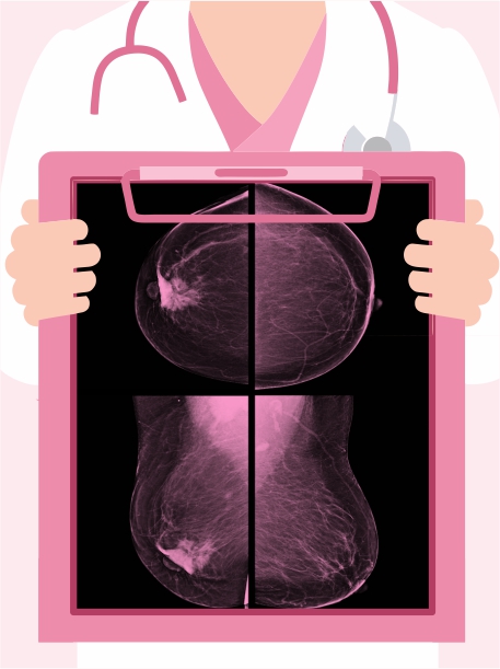 Breast Cancer - Background